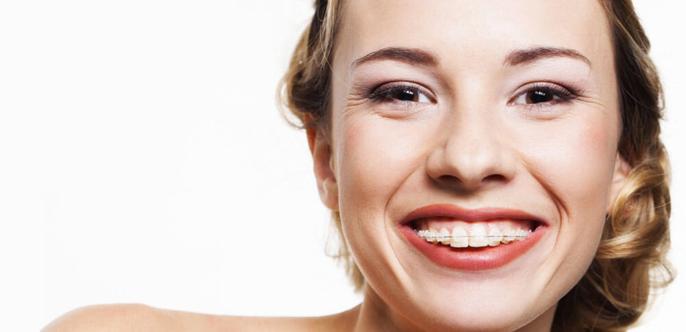 3 Reasons To Consider Adult Braces